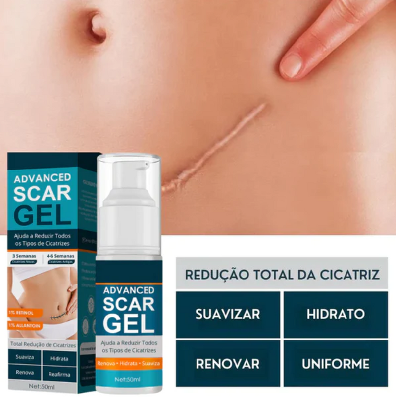 Gel Scar® 100% Advanced Gel - Para todos os Tipos de Cicatrizazes (cesariana, abdominoplastia, cicatrizes antigas, queloides, estrias, queimaduras)