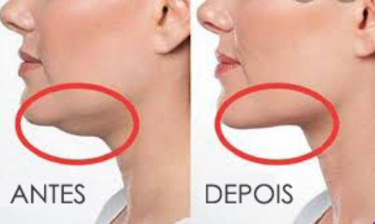 Massageador Neck Facial®