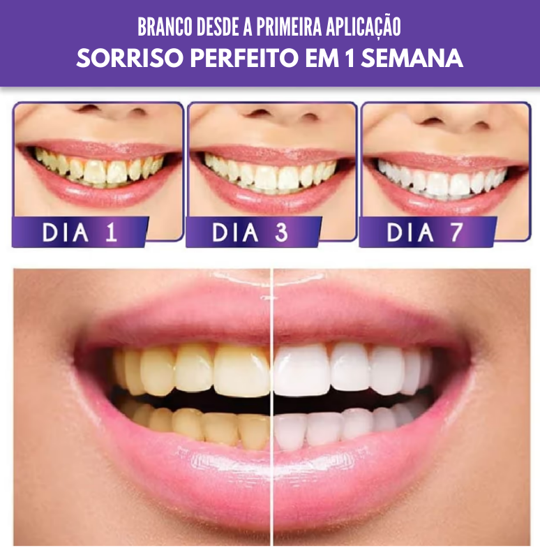 Creme Branqueador EELHOE SMILE® Natural 30ml